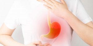 Gastroesophageal,Reflux,Disease,(gerd),Or,Acid,Reflux,Symptoms.,Woman,Suffering